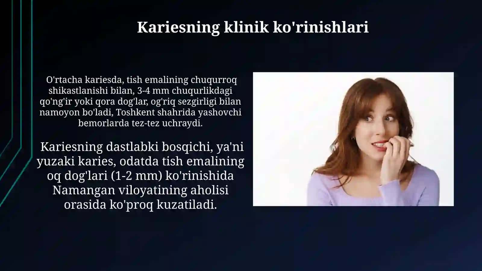 Karies kasalligi va profilaktikasi 3