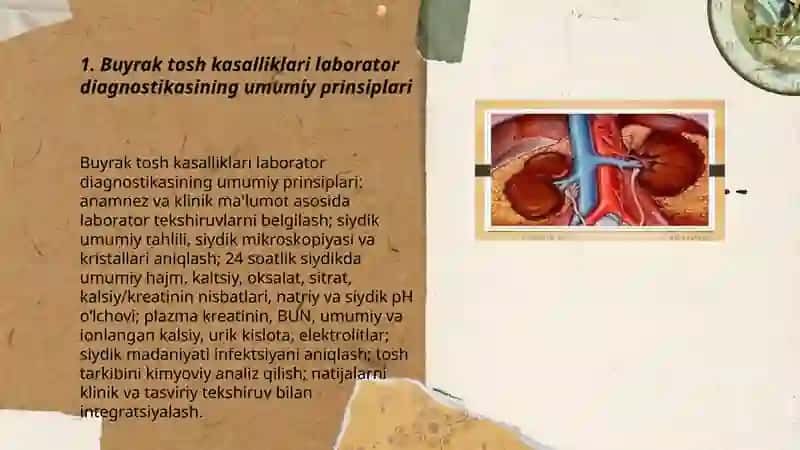 Buyrak tosh kasalliklari laborator diagnostikasi 3