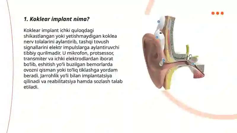 Koklear implant 3