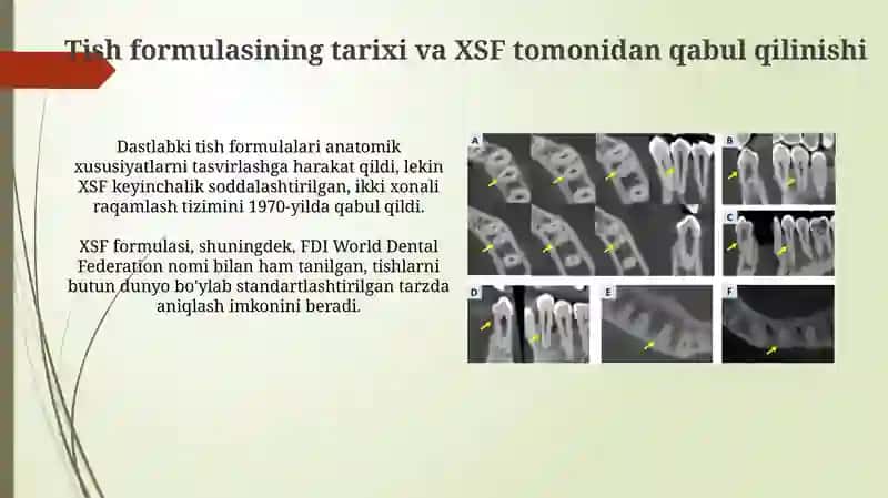 Sutdoimiy tishlar klinik anatomik formulasi 3