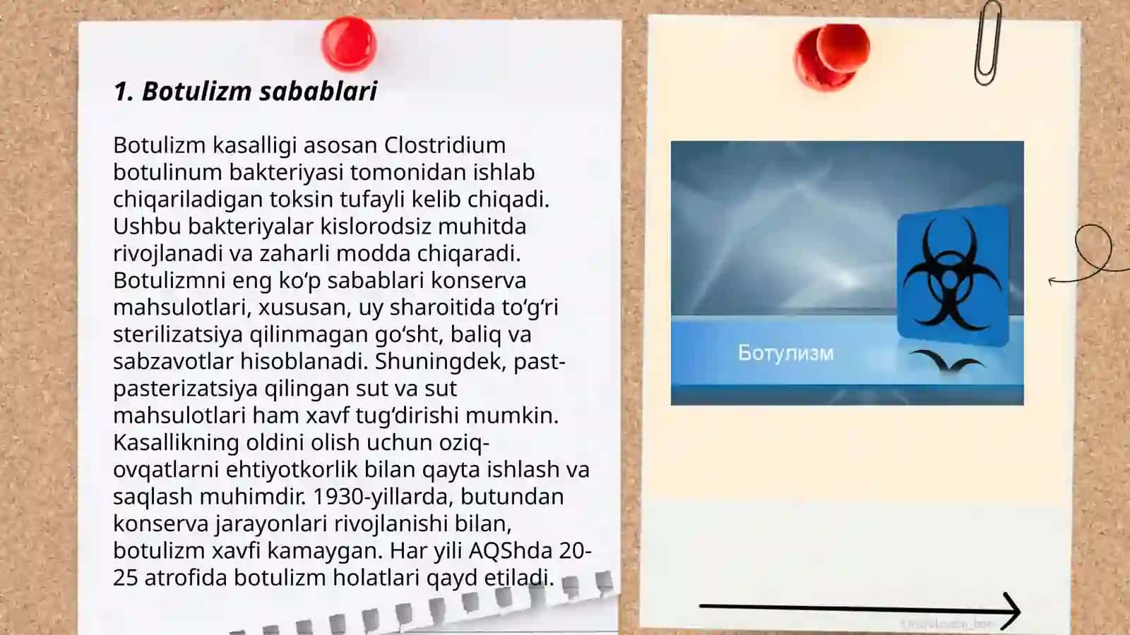 Botulizm, ovqat toksiko infeksiyasi 3