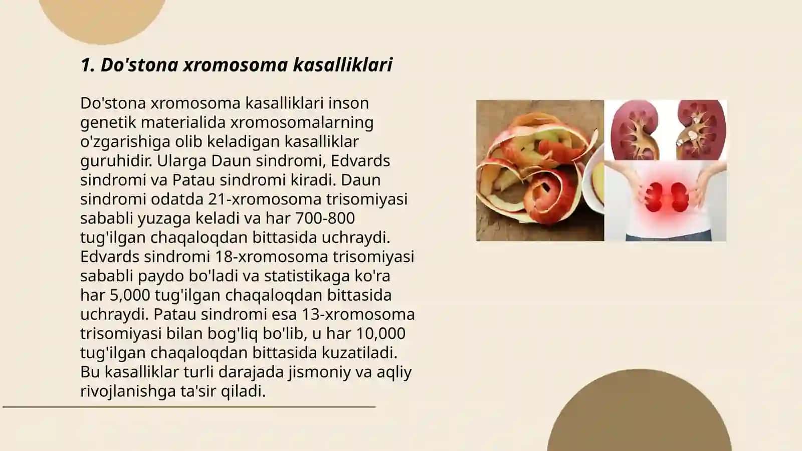 Do'stona xromosoma kasalliklari 3