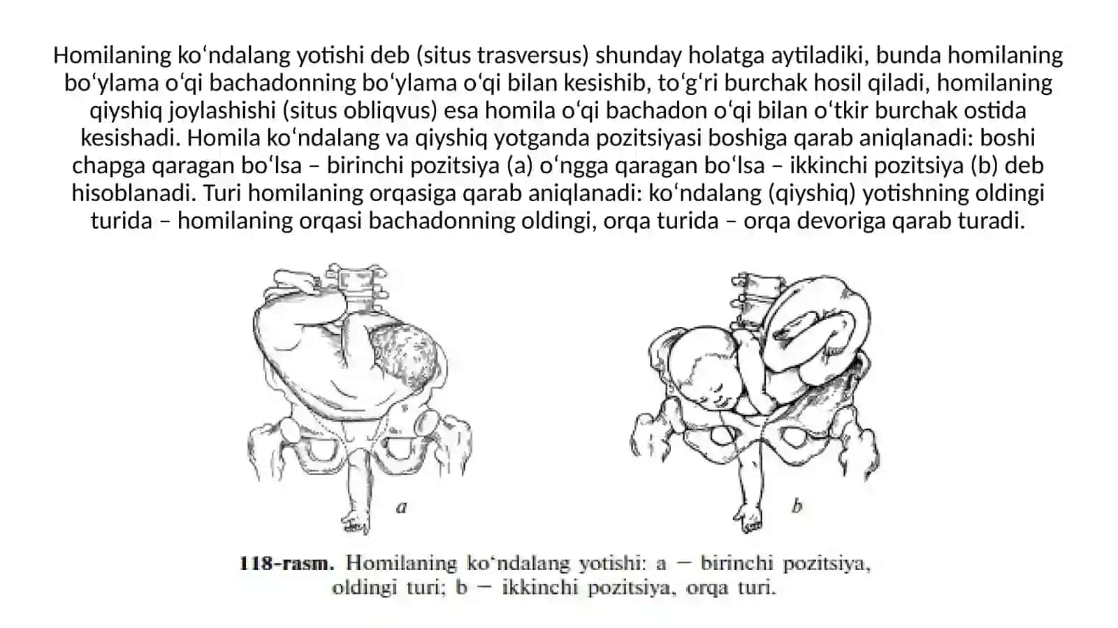 Homilaning noto'g'ri joylashishi 3