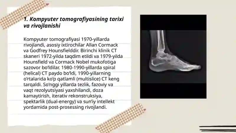 Kompyuter tomografiyasi 3