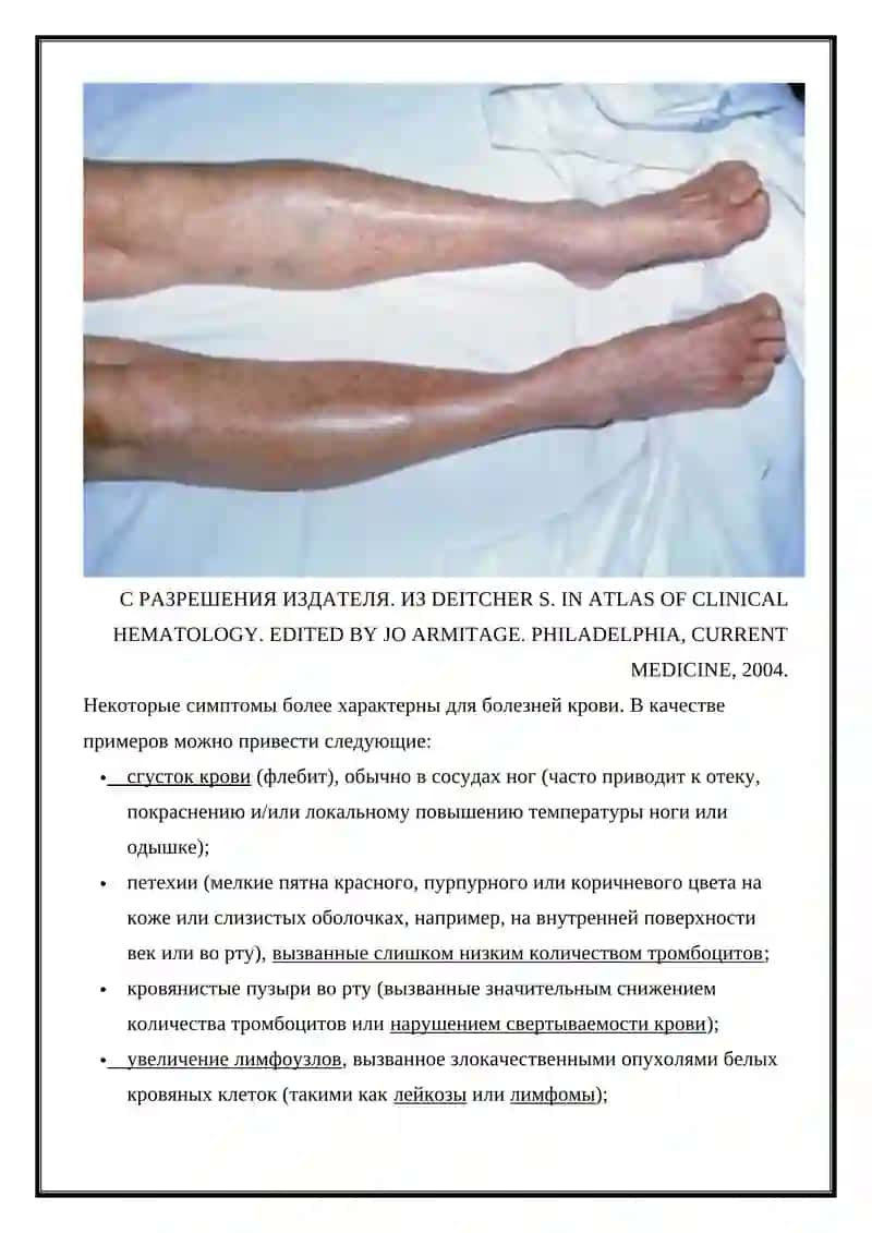Заболевания крови 3