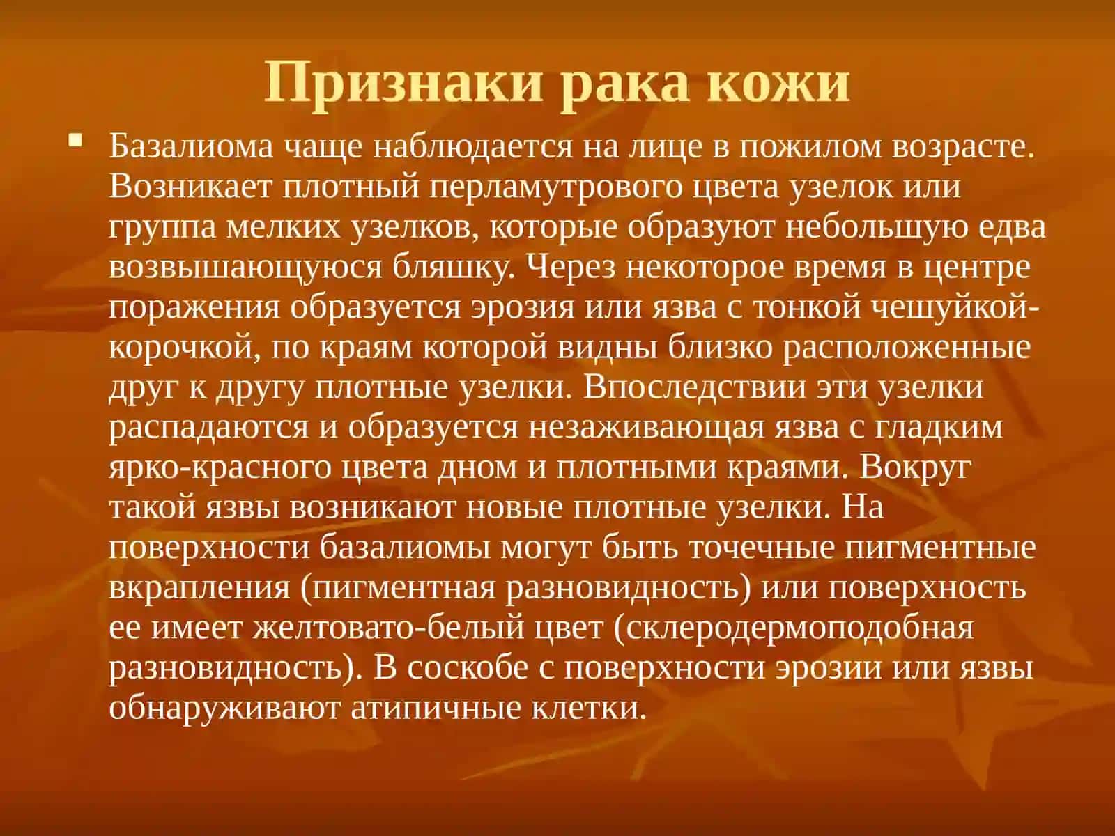 Рак кожи 3