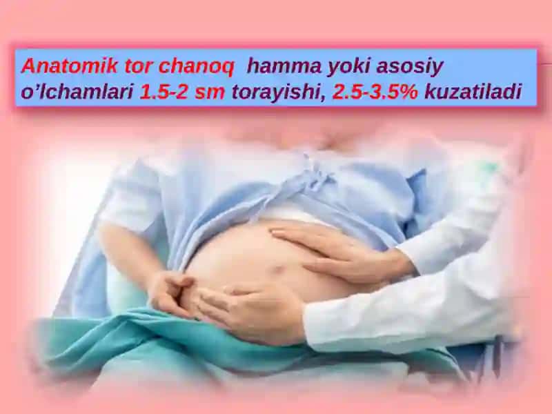 Chanoqanomaliyalar 3