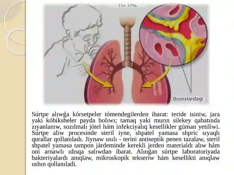 Súrtpe aliw ham qaqiriq aliwga korsetpeler, maqseti ham jiynaw usillari 3