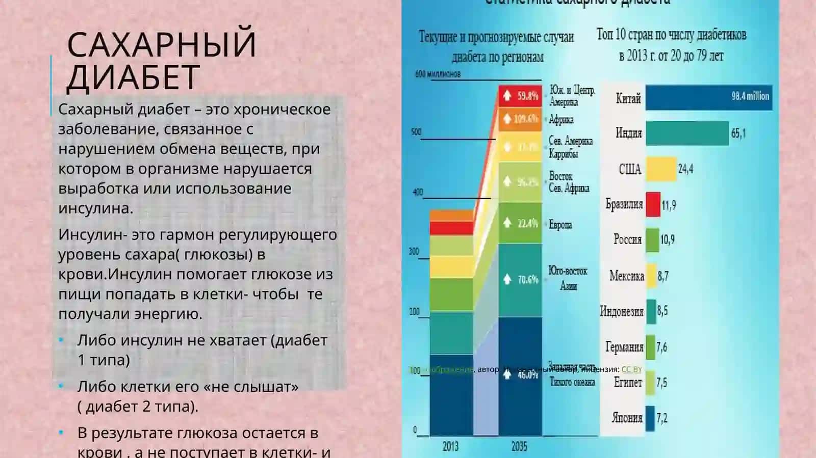 Сахарный диабет 1 типа 3