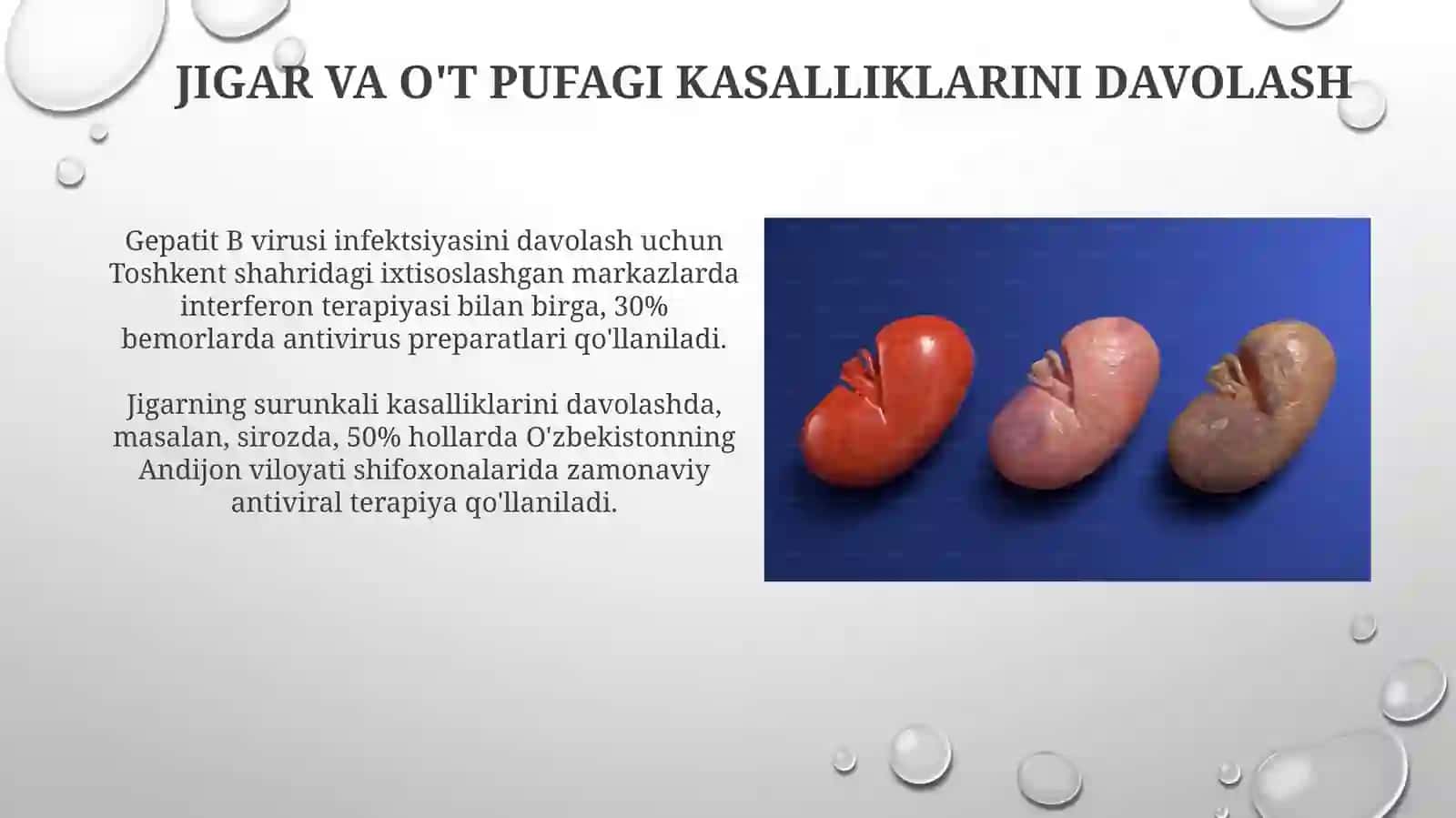 Jigar va o't pufagi kasalliklari 3