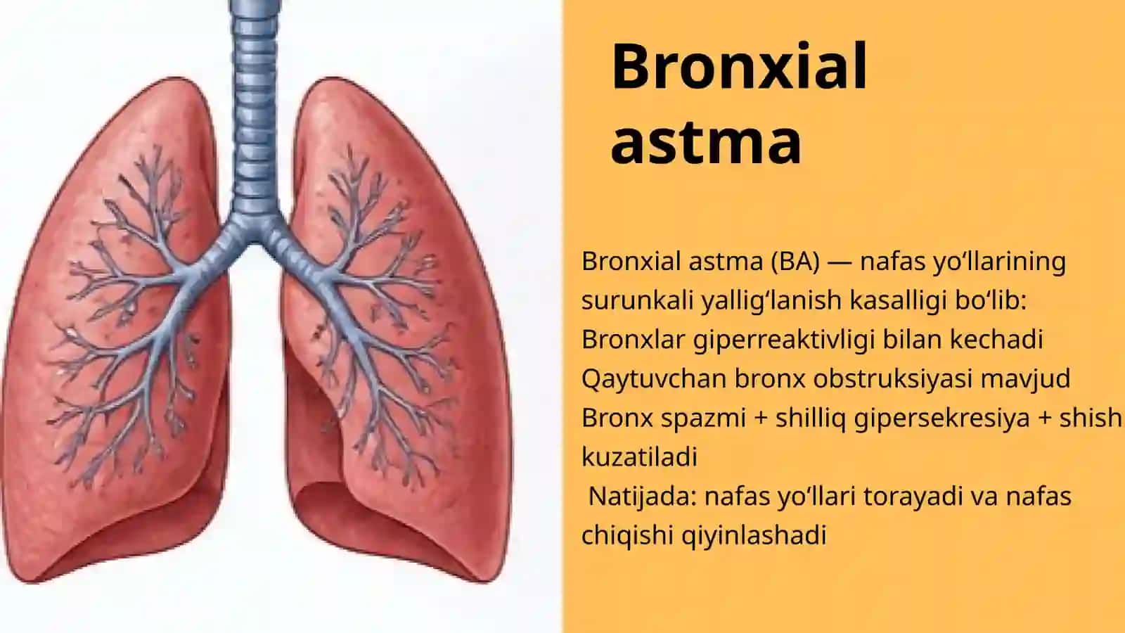 Bronxial astma 3