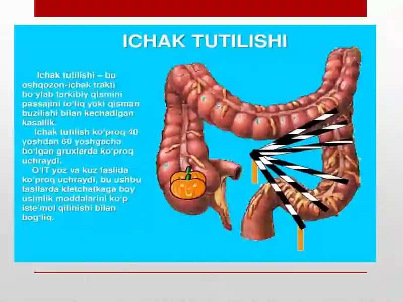 Bolalardao’tkirichaktuzilishisindiromlari 3