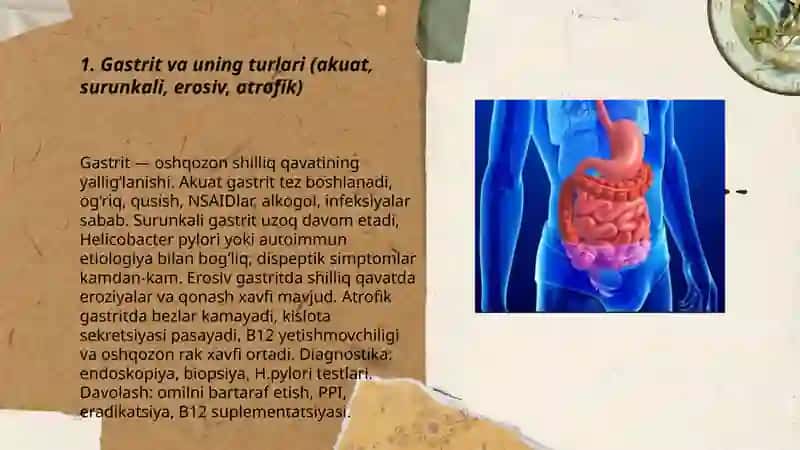 Gastrit va òn ikki barmoqli ichak 3