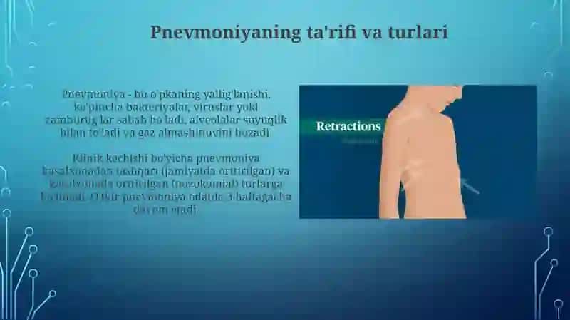 Pnevmoniyasimtomatologiyasi,diagnostikkriteriyalari 3