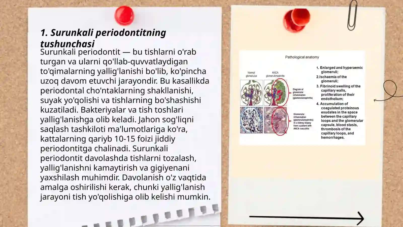 Surunkali periodontitning patologik anatomiyasi 3