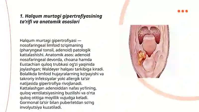 Halqum Murtagi Gipertrofiyasi (Adenoidlar) 3