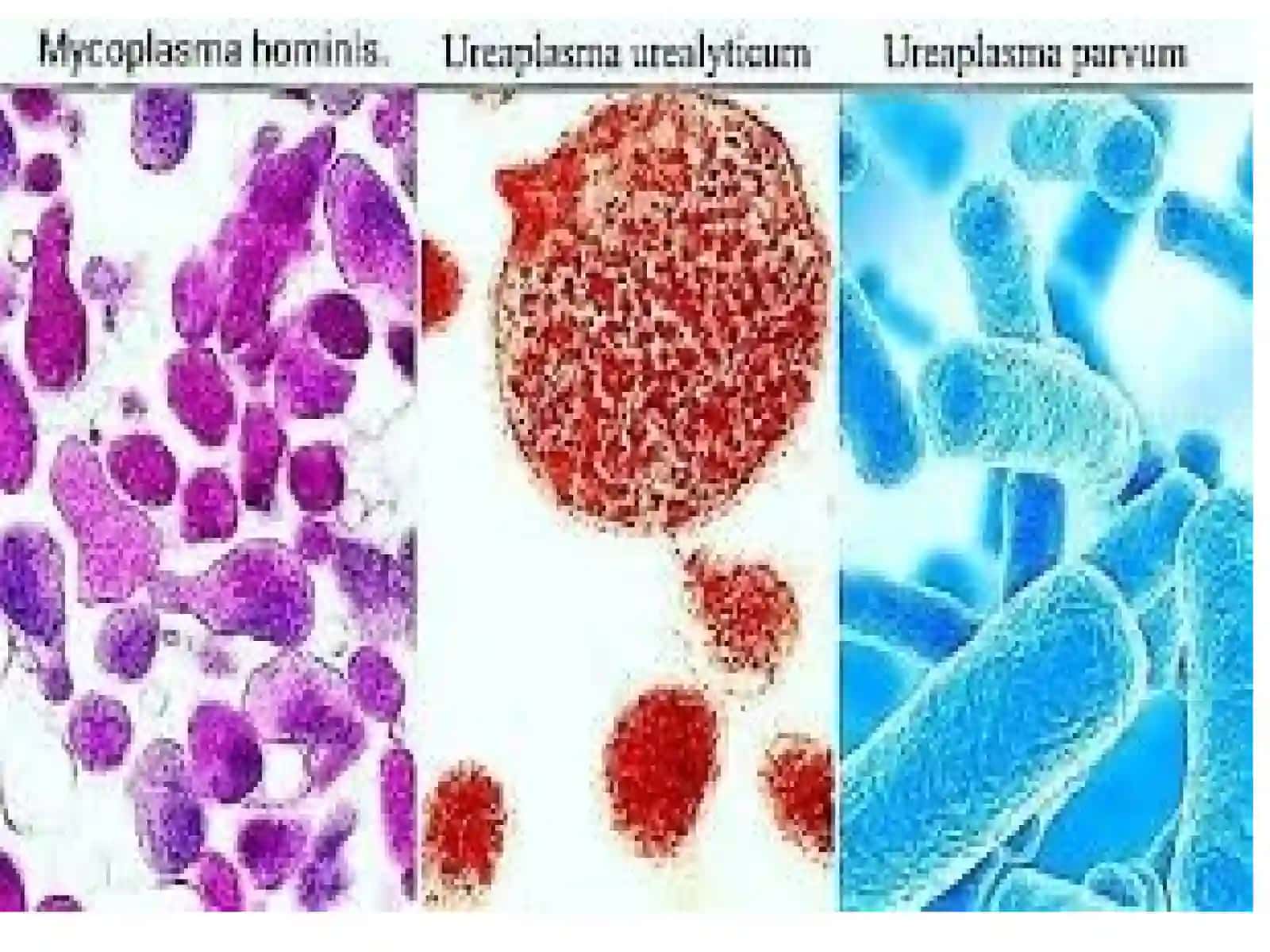 Bakterial vaginoz. Mikoplazmoz, ureaplazmoz 3