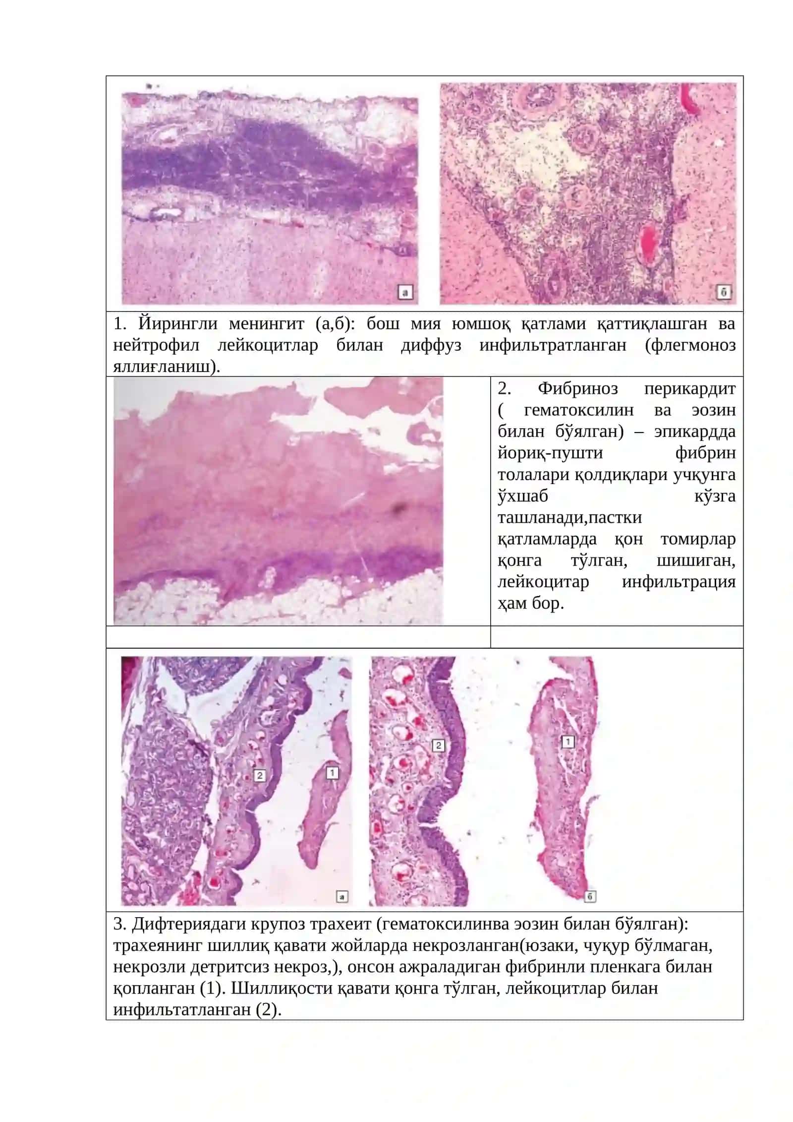 Яллиғланиш ва репарация 3
