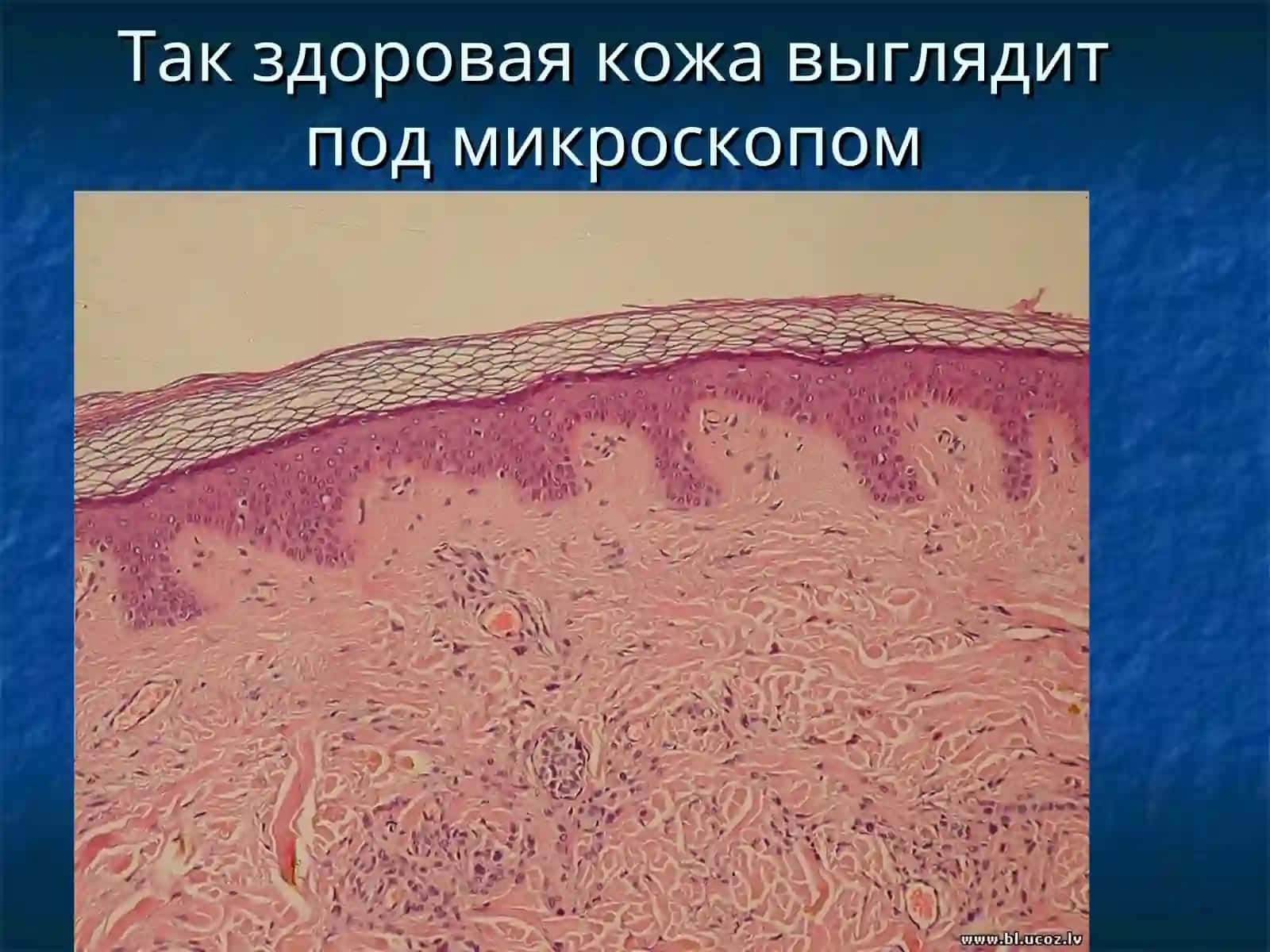 Дерматовенерология 3