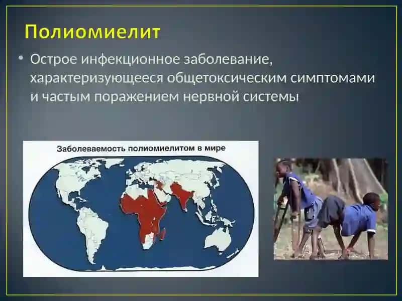 Этиология, эпидемиология 3