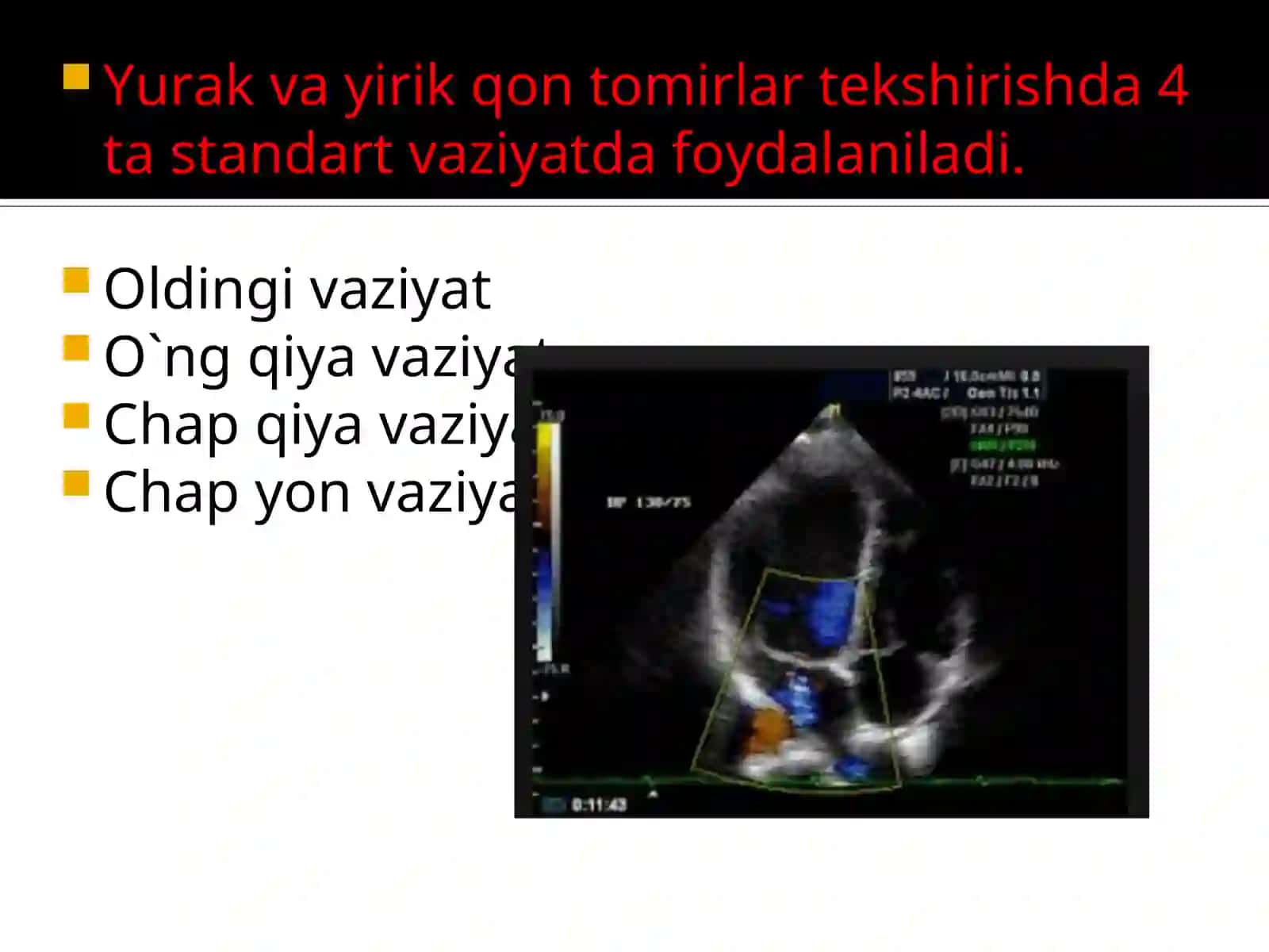 Yurak va yirik qon tomirlarni rentgenologik tekshirish usullari 3