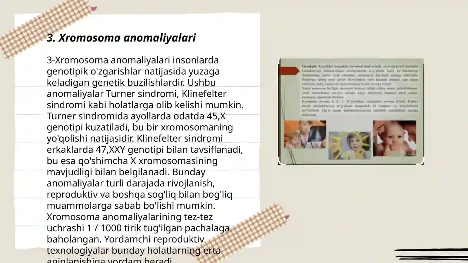 Xromasoma kasalliklari 3