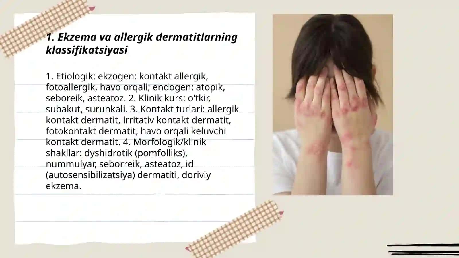 Ekzema va allergik dermatitlar 3