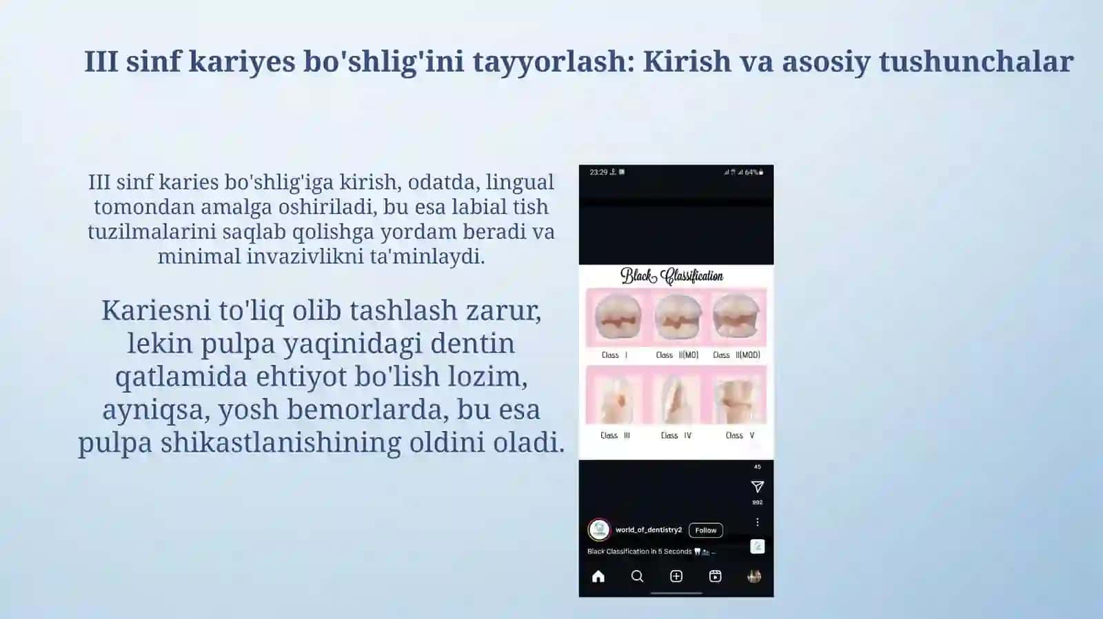 III sinf karioz bo'shliqlarni charxlash va plombalash 3