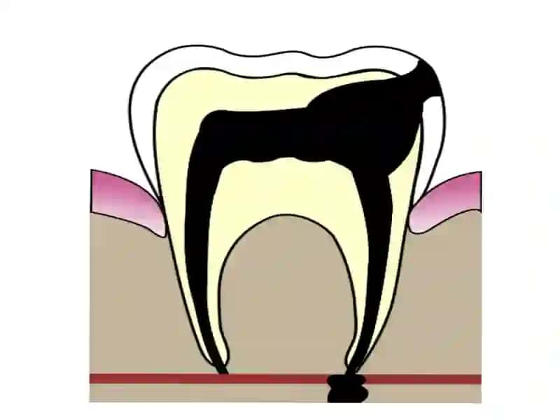 SURUNKALIPERIODONTITLAR.KLINIKASI.TASHXISLASHVAQIYOSIYTASHXISLASH STOM-2.410"A"GURUH 3