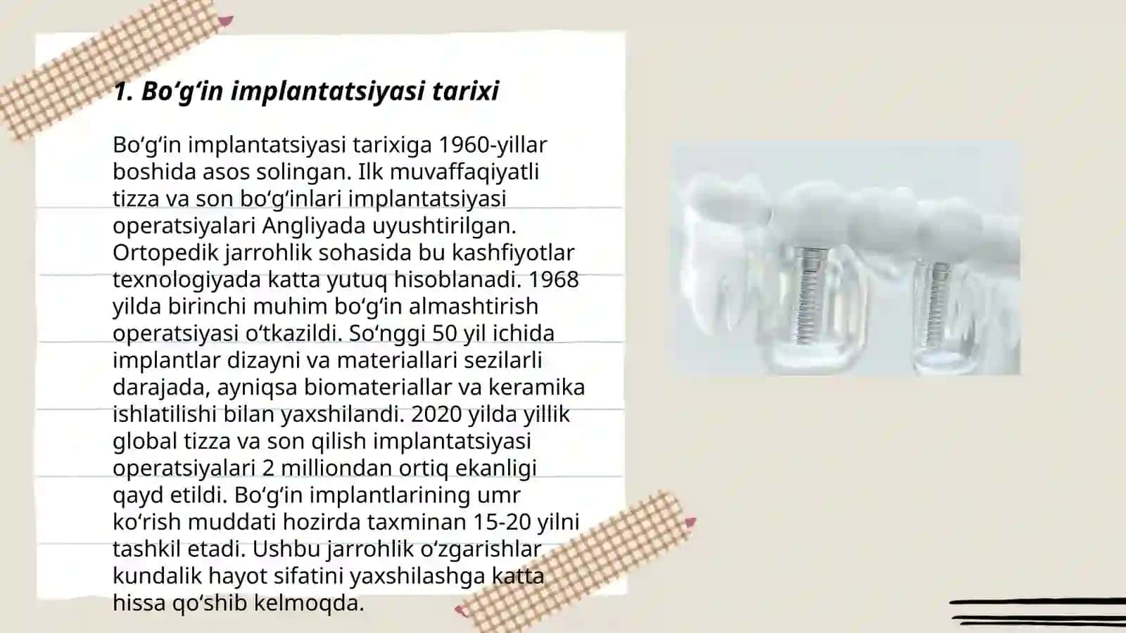 Boʻgʻimlar implantatsiya 3