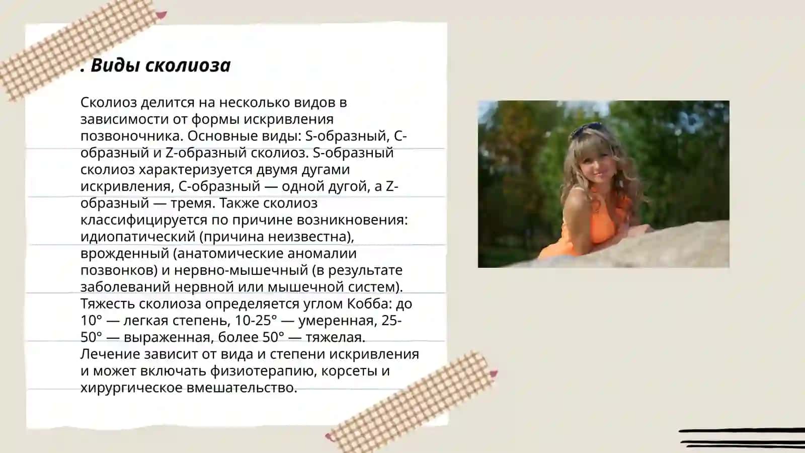 Виды сколиоза 3