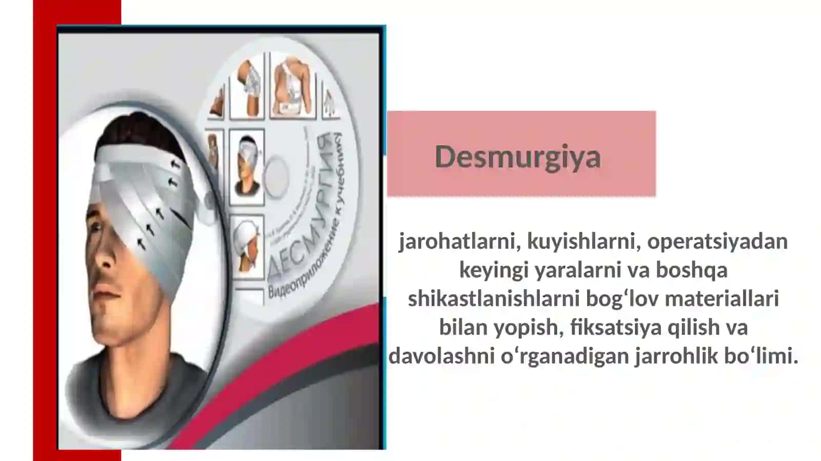 desmurgiya bog'lov turlari 3
