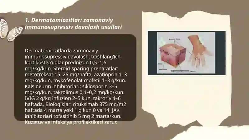Dermatomiozitlar.Vitiligoning zamonaviy davolash usullari 3