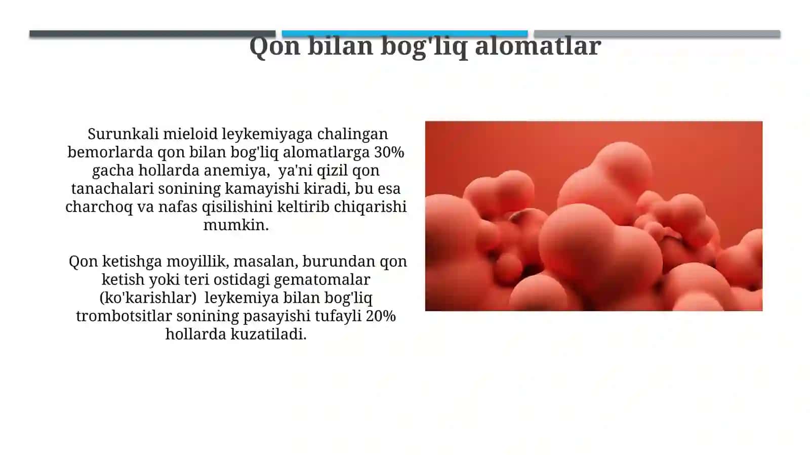 Surunkali mieloleykoz simptomatologiyasi 3