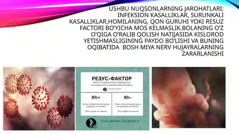 Bolalar serebral falaj 3