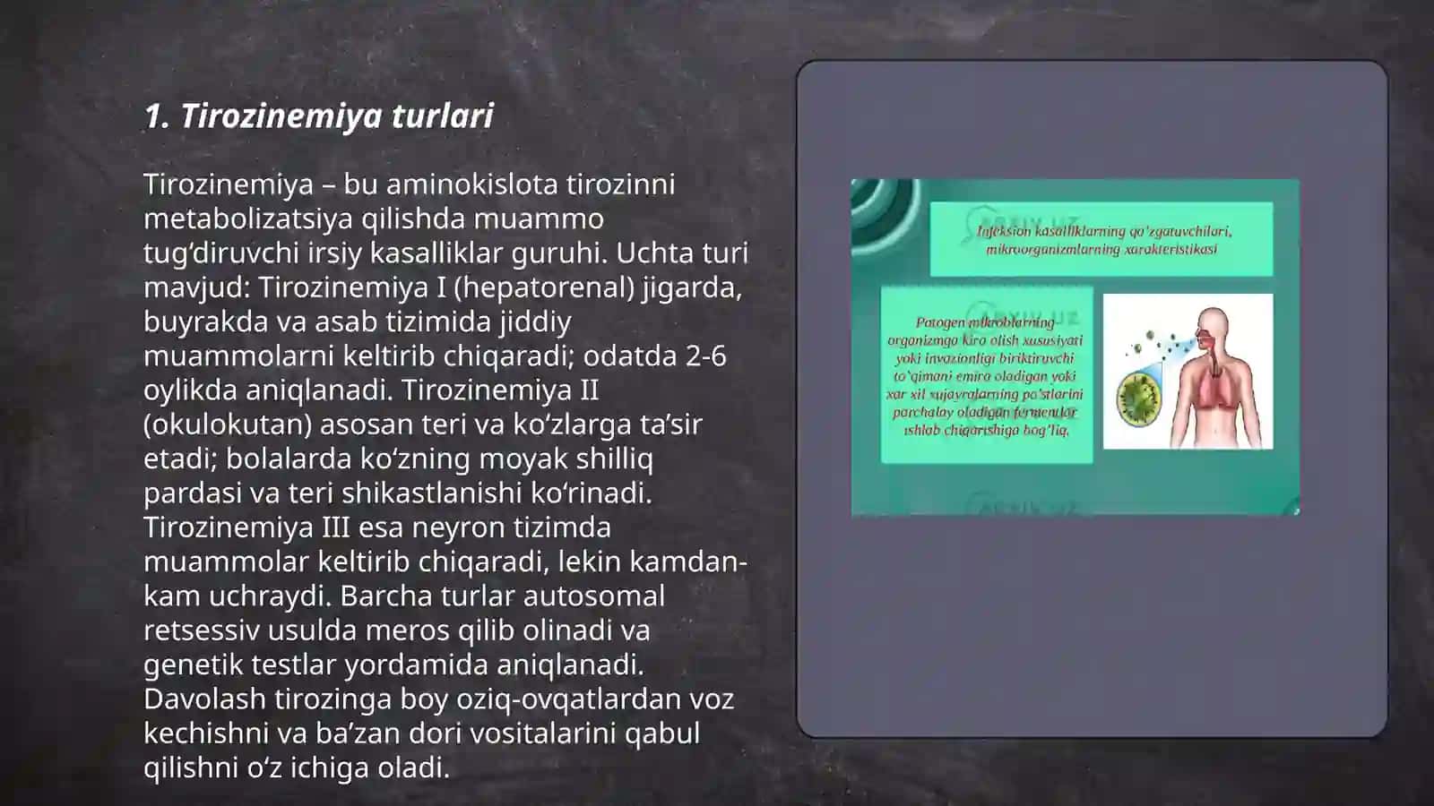 Tirozinemiya kasaligi 3