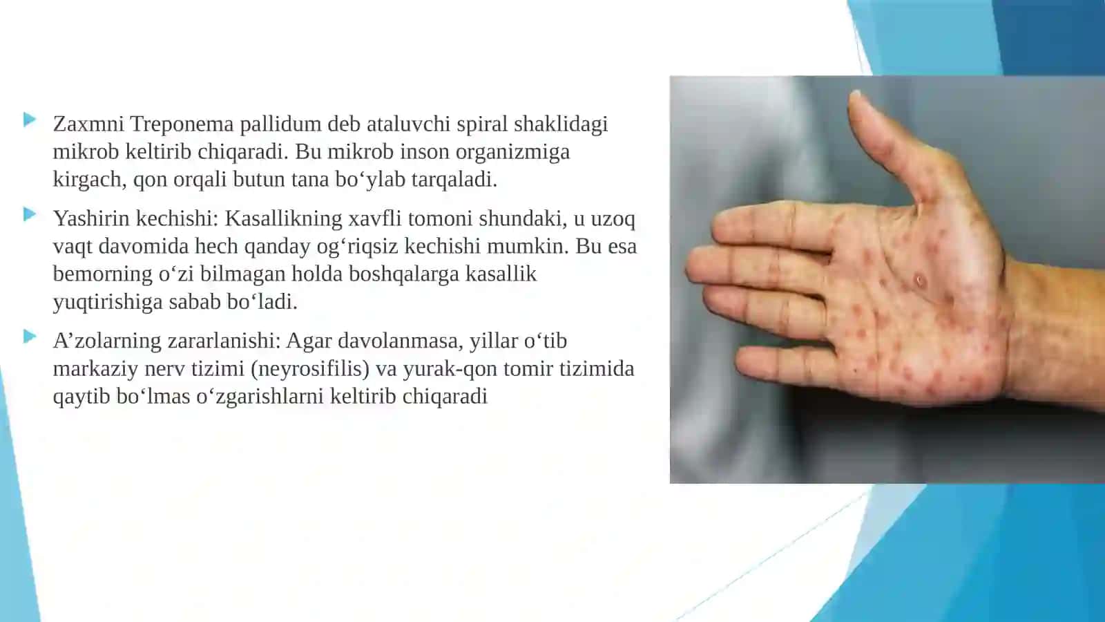ZAXMGA QARSHI VOSITALAR 3