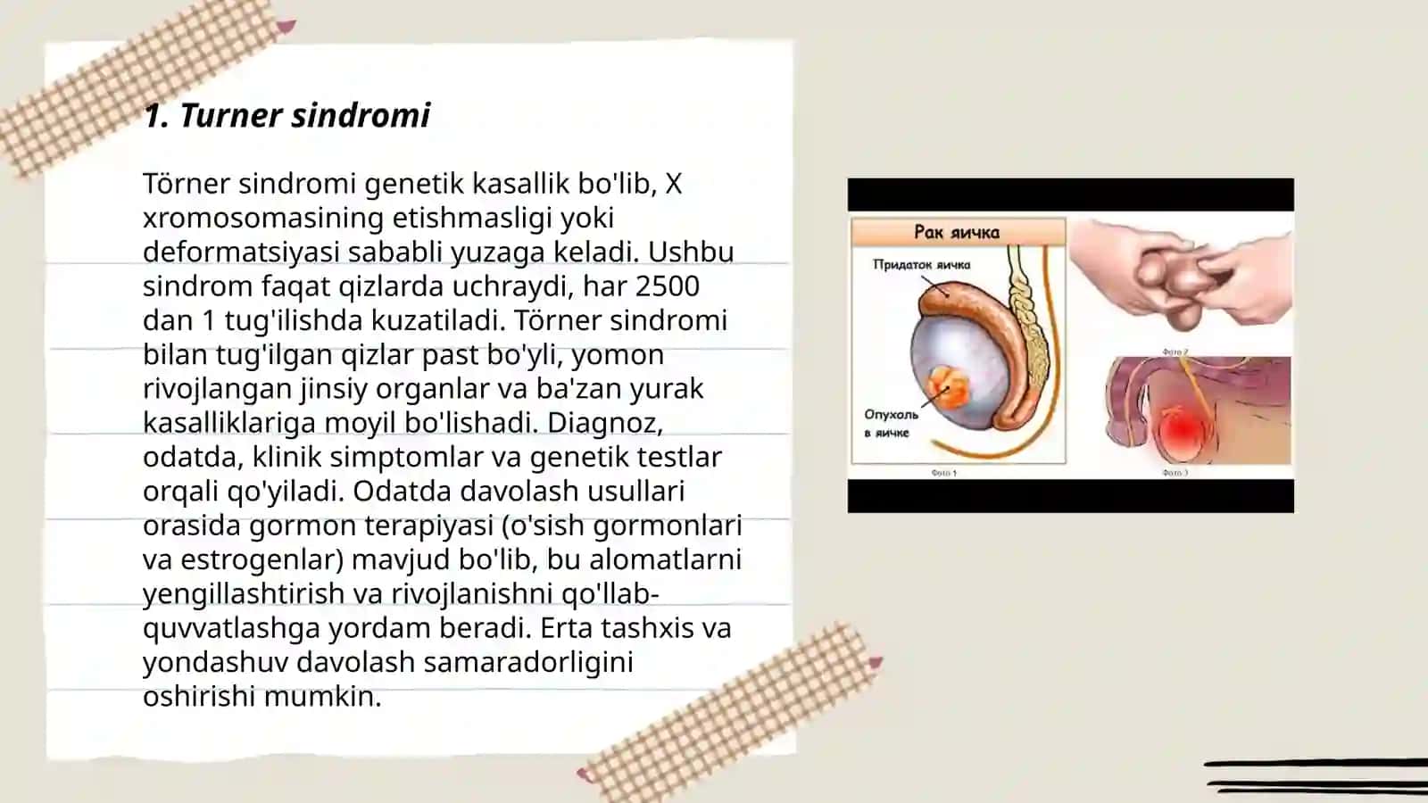 Xromosoma kasalliklari 3