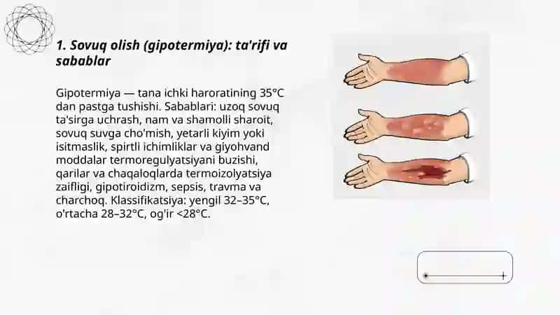 Sovuq olish, kuyish va ularning turlari 3