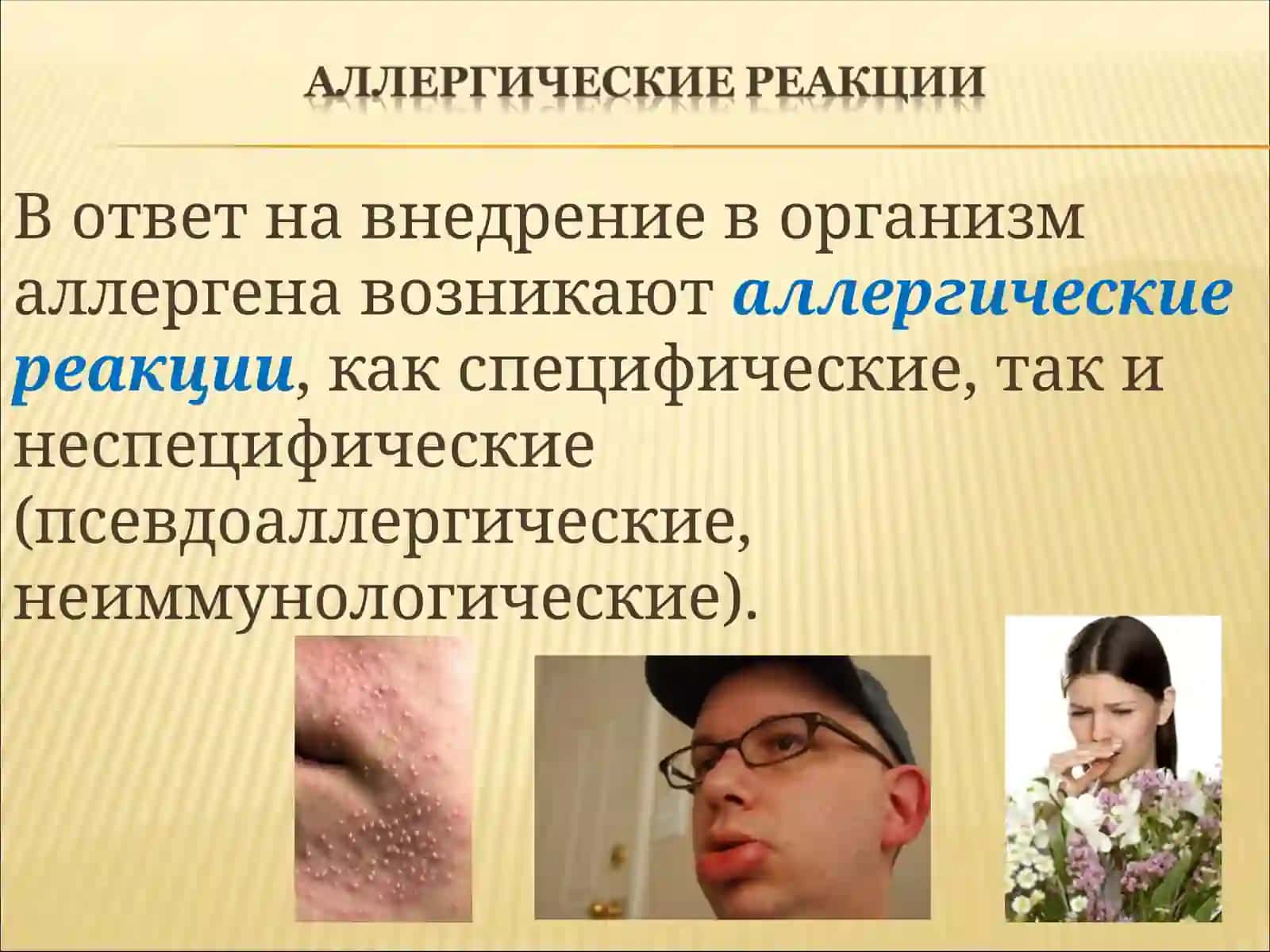 Allergik reaksiyalar 3