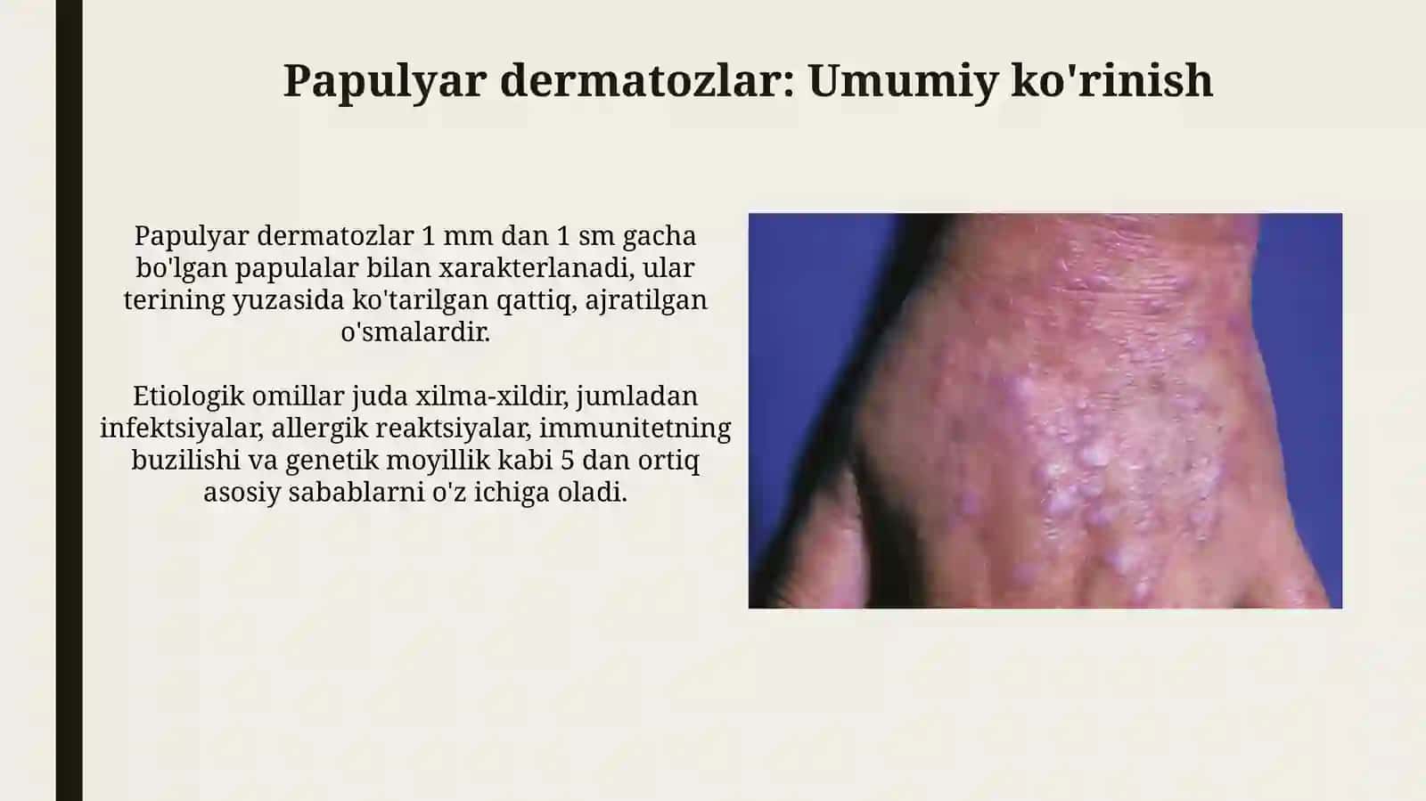 Papulyozdermatozlar va keng tarqalgan tur 3