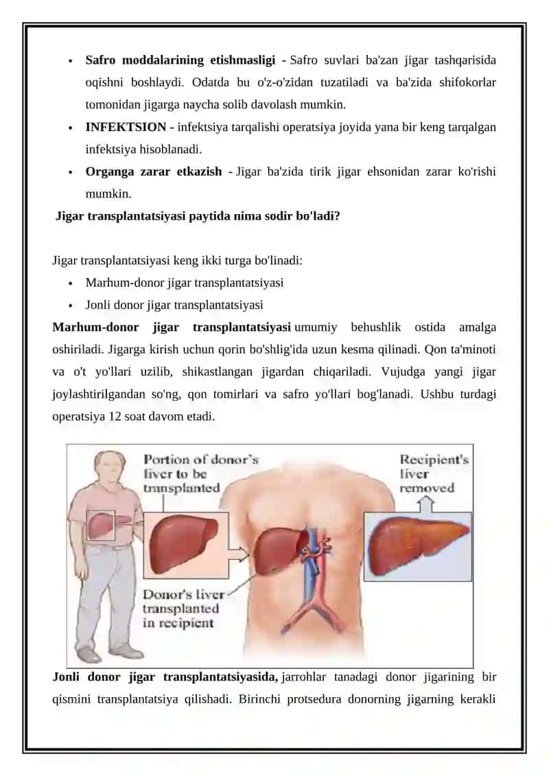 JIGAR TRANSPLANTATSIYASI 3