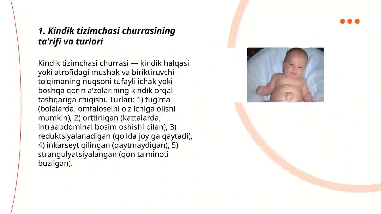 Kindik tizimchasi churrasi 3