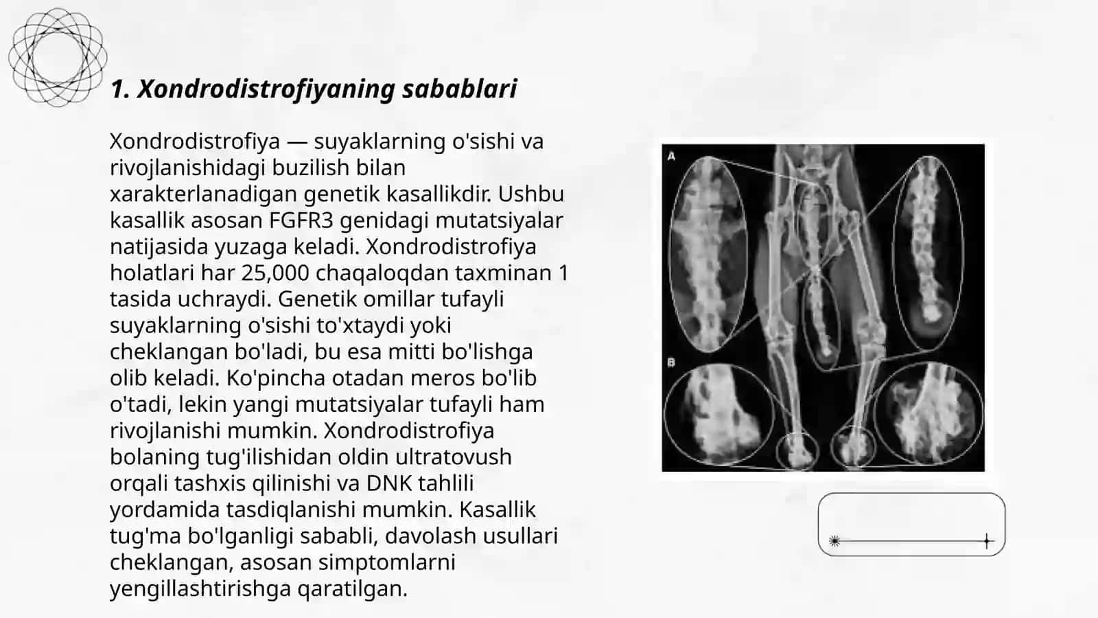 Xondrodistrofiya 3