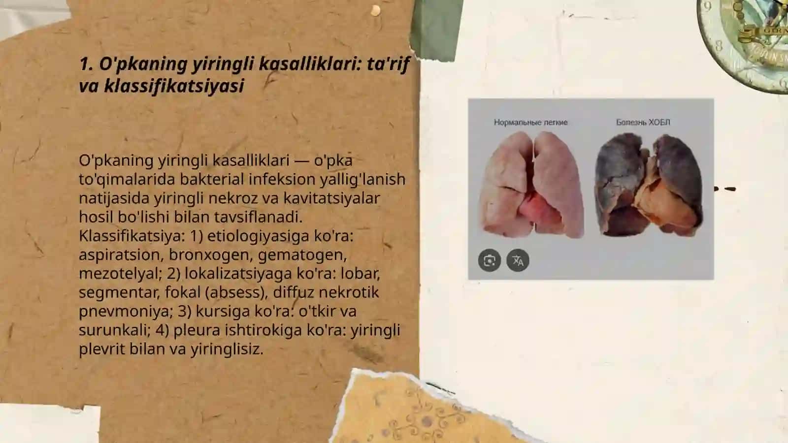 O'pkaning yiringli kasalliklari.Plevritlar.Klinikasi 3