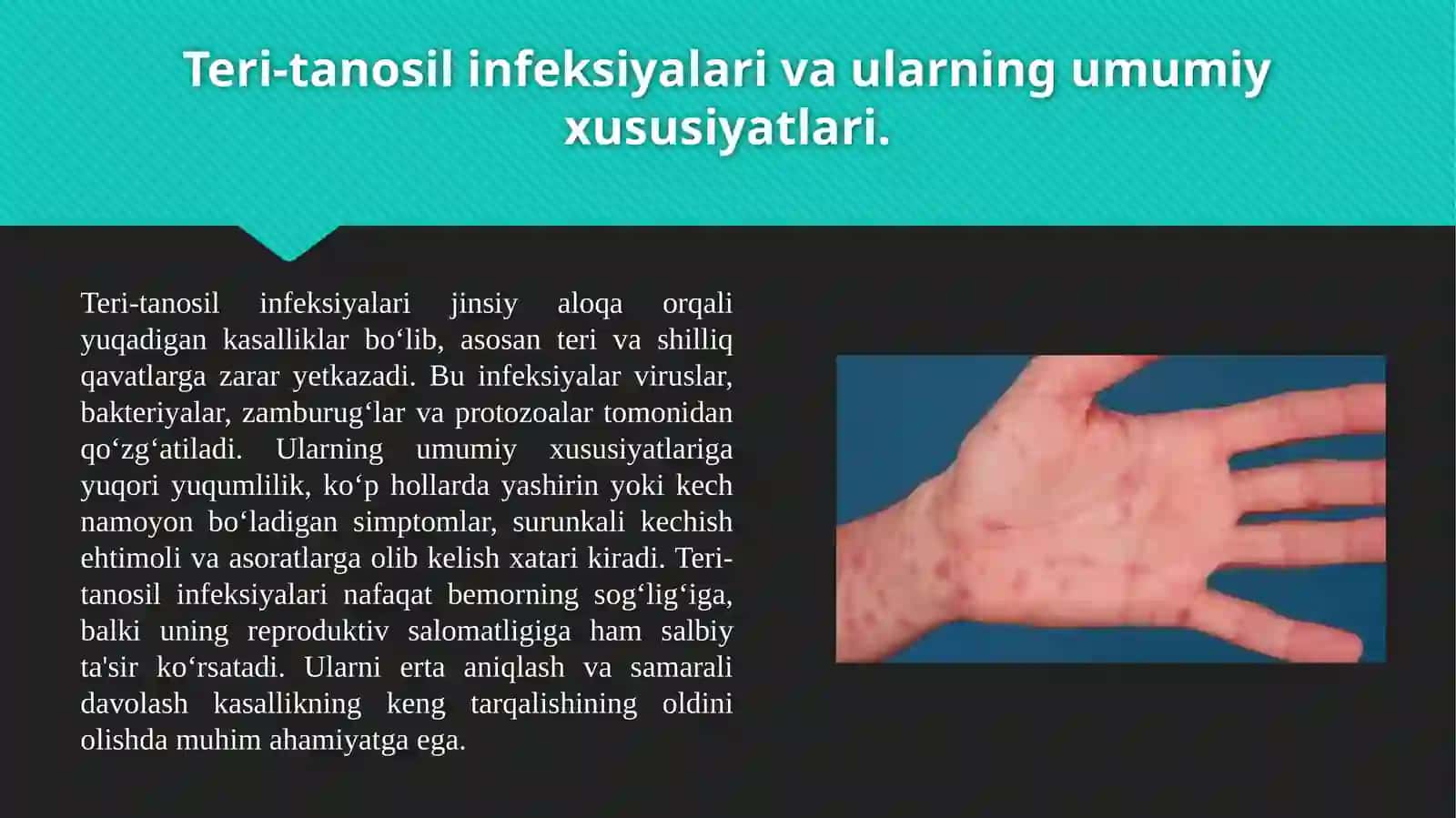 Teri-tanosil infeksiyalar 3