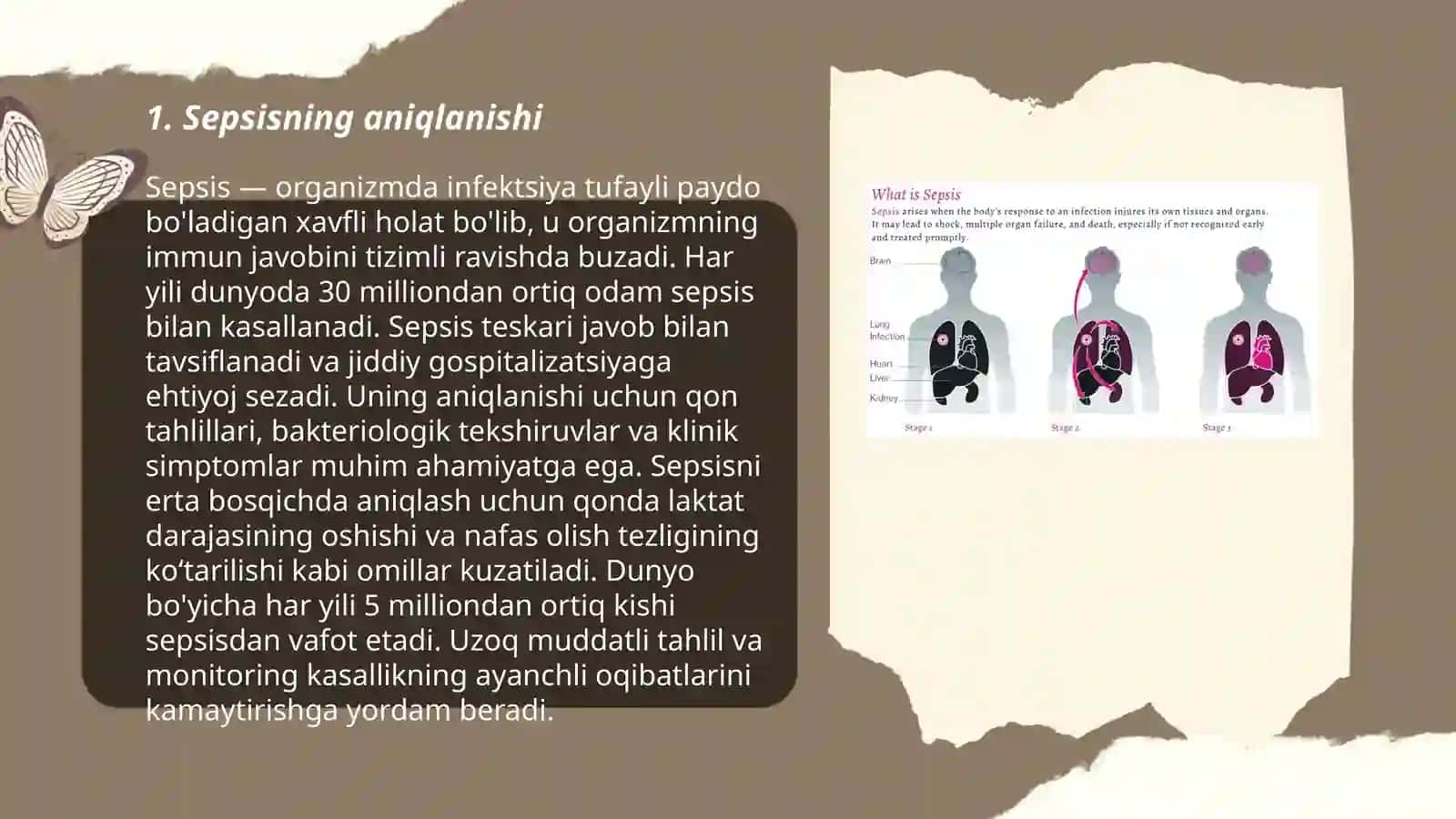 Sepsisning zamonaviy tasnifi 3