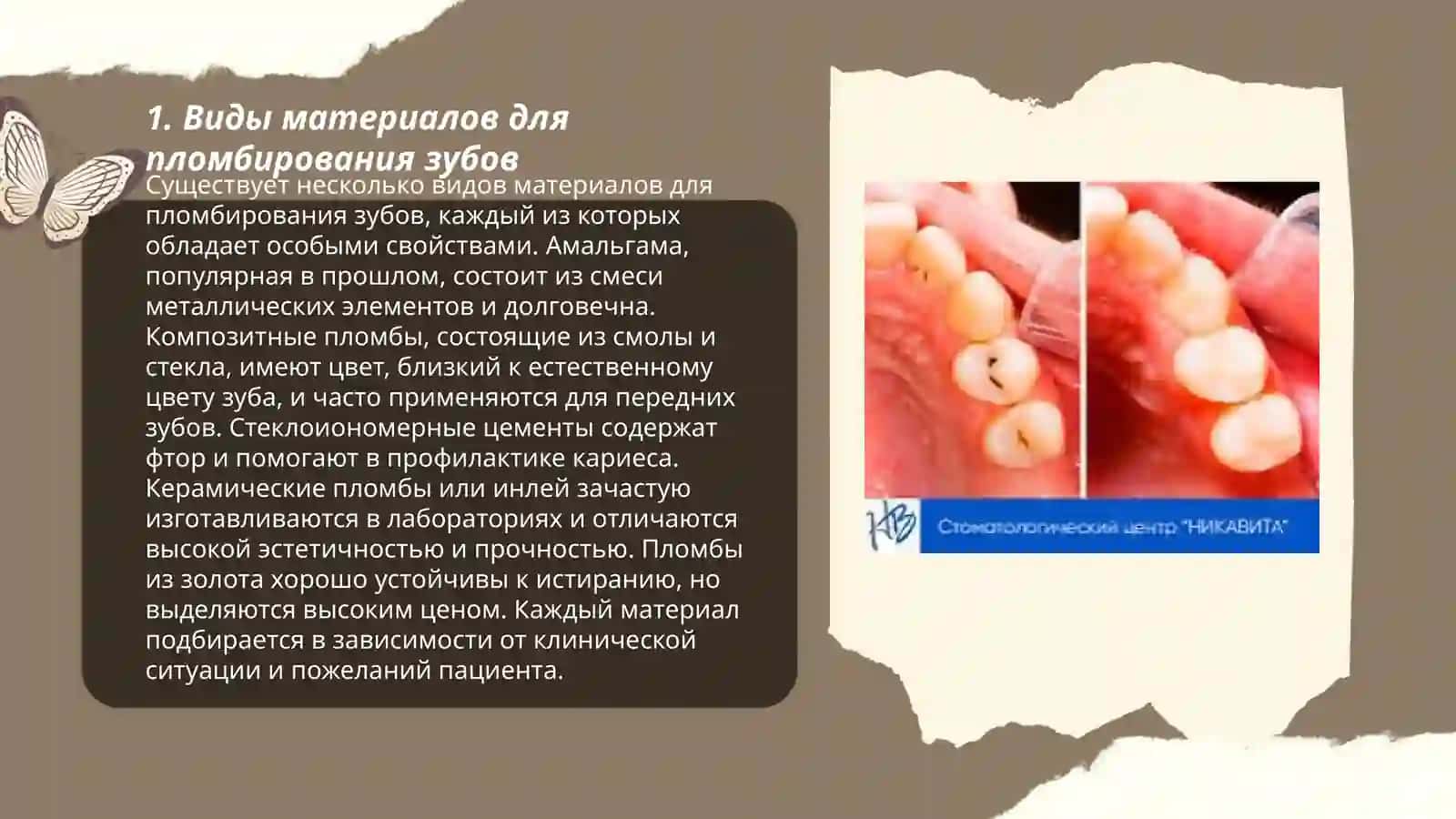 Пломбирование зубов 3