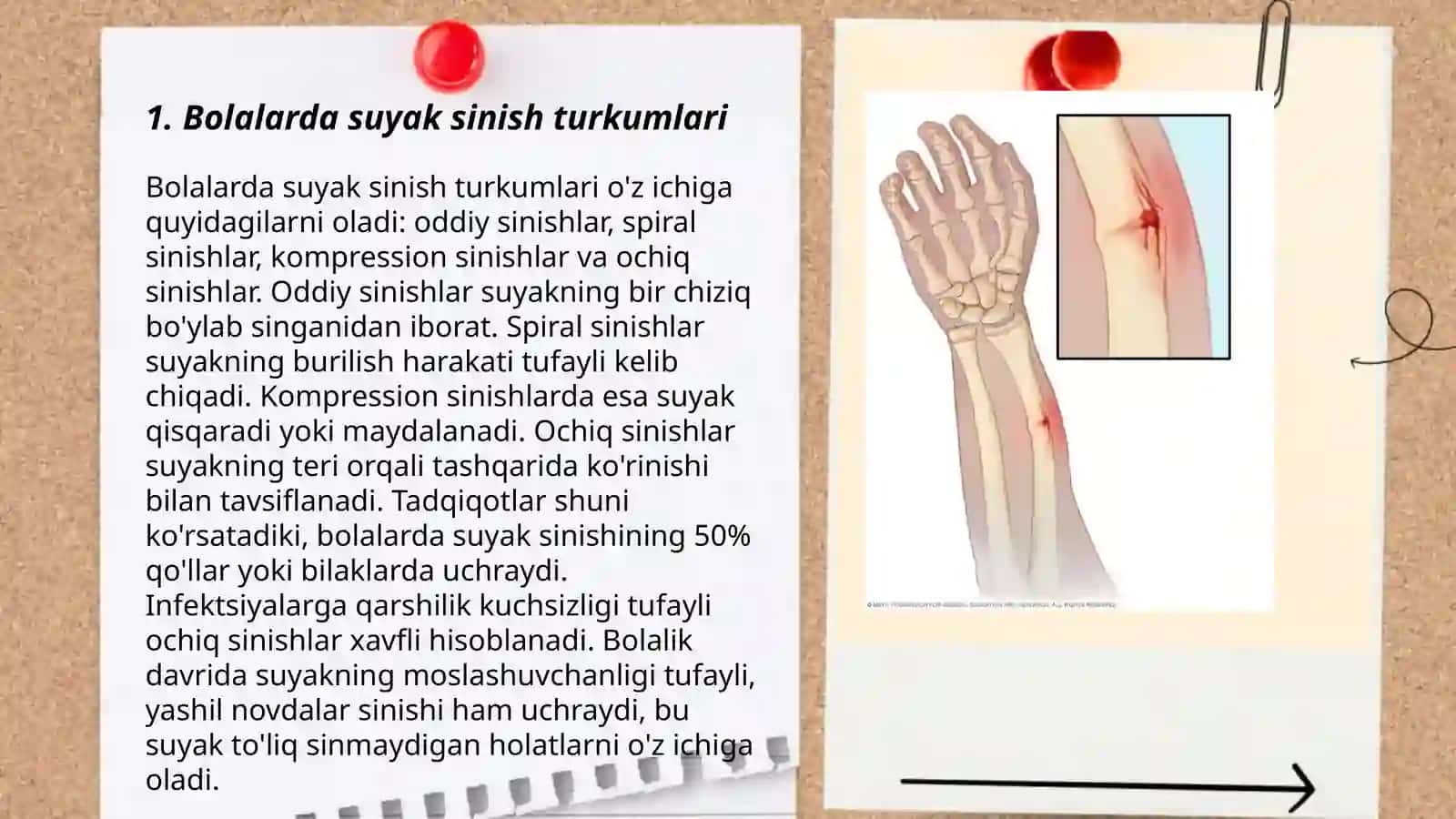 Bolalarda suyak sinishlari 3