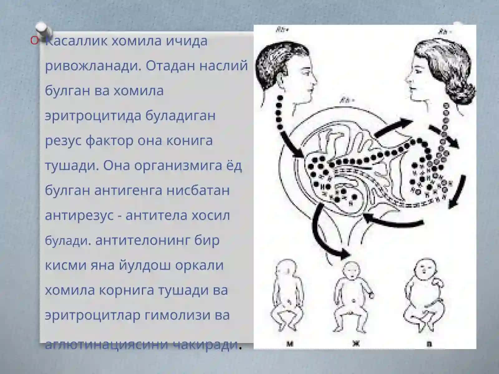 Чақалоқларда сариқлик. ЧГК 3
